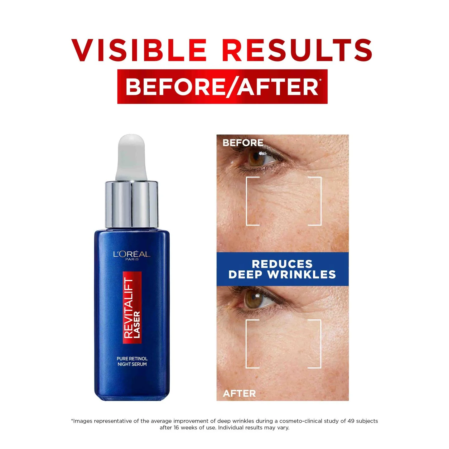 retinol L'OREAL 2